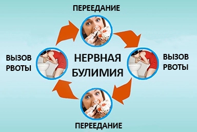 Лечение булимии в Полтавской